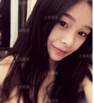 美萊案例晨晨對(duì)比圖后