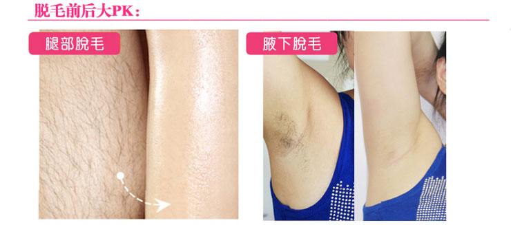 激光脫毛整容手術(shù)需要多少錢(qián)呢