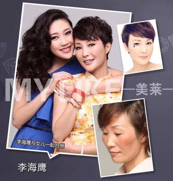 化妝品會讓黃褐斑增長嗎，預(yù)防黃褐斑有哪些方法