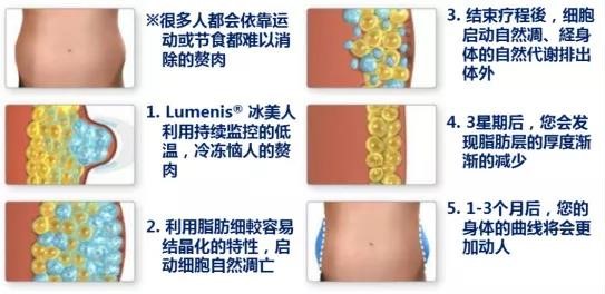 秋冬美麗不打折！讓美萊曹?chē)?guó)靖醫(yī)師帶你一起【晶準(zhǔn)減脂 酷塑體線】