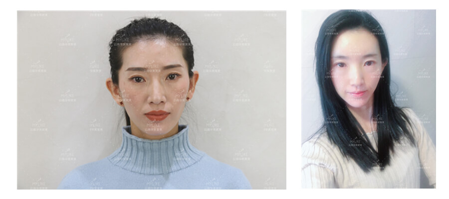 2011年環(huán)球游艇模特大賽十佳及單項獎小姐姐必做的醫(yī)美項目?。∶廊R雙十一get好物推薦
