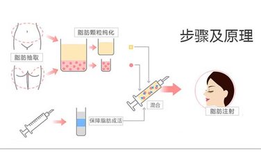豐面頰