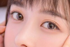 天津激光去眼袋大概需要多少錢？