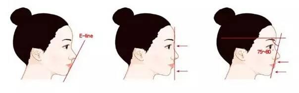 重慶做開(kāi)眼角之后不能吃哪些東西？