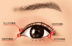 廈門開眼角術(shù)后完全恢復(fù)需多久