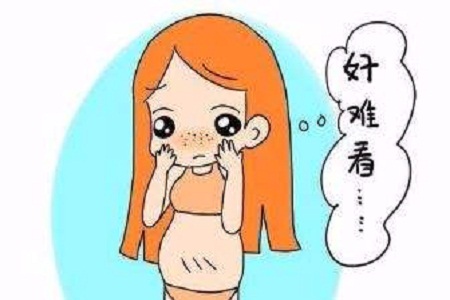 面部色斑