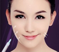 瘦臉針效果能維持多久？