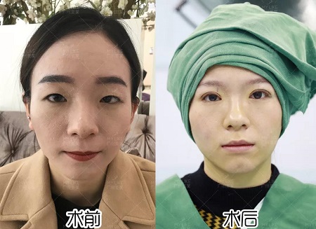 遭萬(wàn)人唾棄的死魚(yú)眼