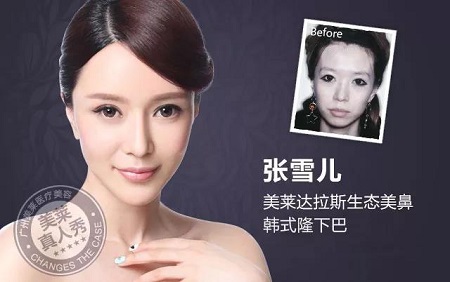  23-24日，韓國較會整容的柳元敏博士，來了！