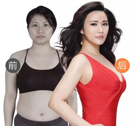 3月27-28日，世界吸脂王志軍來了！