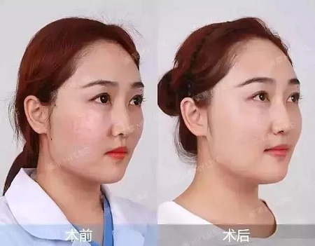 賦活水光3次399元、水光買一送一...春季水光專場，爆款限時(shí)搶！