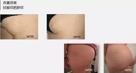 抗衰老的“水光”究竟為何飽受稱贊？