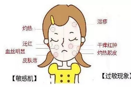 皮膚變成敏感肌怎么辦？如何修復(fù)敏感肌？