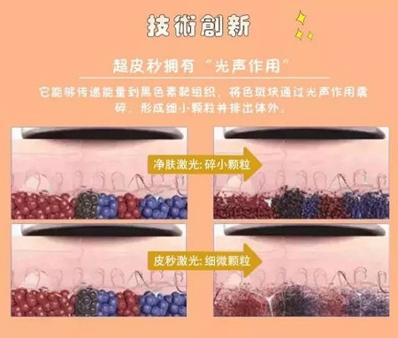 祛斑