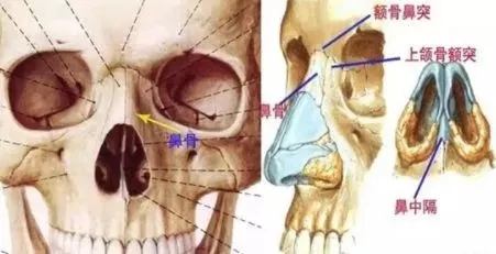 側(cè)面看鼻梁不矮,正面看鼻子卻很塌是什么原因？