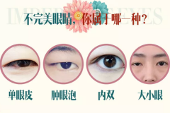鄭州美萊整形雙眼皮多少錢(qián)？