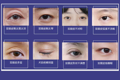 鄭州美萊整形眼修復多少錢？